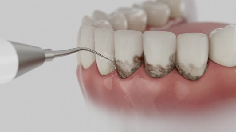 Trusted Tooth Extraction service in Warren, PA - Dentist Open Now